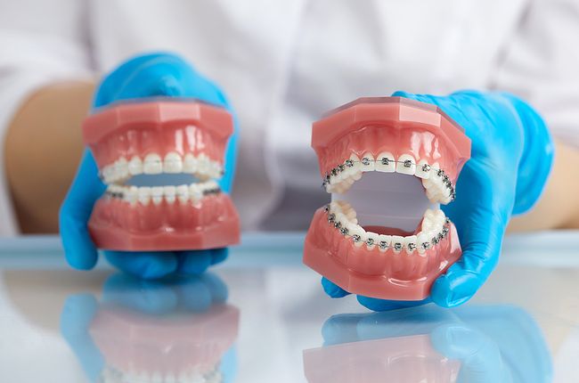 Orthodontics Orthodontics